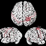 Sguardo comparativo ravvicinato al cervello di Einstein