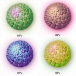 HPV-Warholizzato