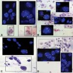 TERC_gene