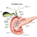 pancreas
