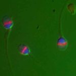 spermatozoi