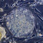 stem_cell