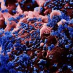 h5n1