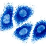 HCV