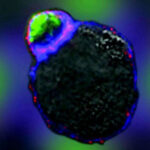 NKTumorCell