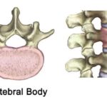 vertebral_body