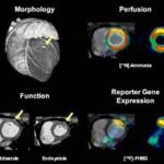 cardiac_genes