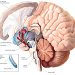 parkinson_1