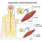 SLA