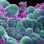 cellule_cancerose