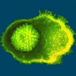 Varicella