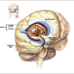 parkinson
