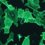 stem_cell_vagina