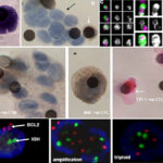 Ctc-circulating-tumor-cells