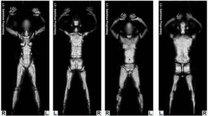 body scanner 300x168 Body Scanner: esperti a confronto sui rischi cancro