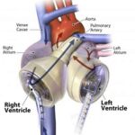 l'immagine potrebbe non essere l'organo artificiale descritto nell'articolo