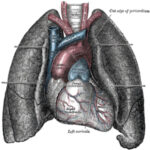 lung_transplantation
