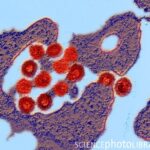 retrovirus