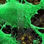 Cancer_cell-brain