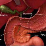 Pancreatic-Cancer