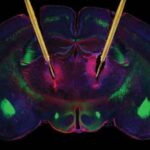 deep_brain