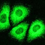 hepatitis_c
