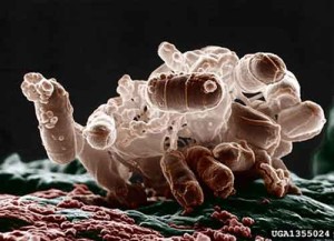 Escherichia coli 300x217 Allarme batterio killer: Germania e altri 4 paesi coinvolti