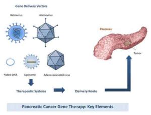 ag ag 300x228 Tumore al pancreas: virus geneticamente modificato arriva alle cellule malate e le distrugge