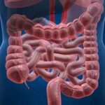cancro_colon