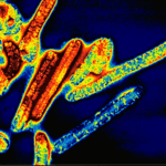 ebola