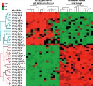 microrna 300x279 Tumore al polmone: grazie al microRNA potrebbe essere diagnosticato con due anni di anticipo
