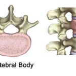 vertebral_body