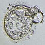 An early-stage cloned embryo called a blastocysts is pictured in this undated handout photo