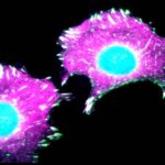 cellule_tumorali_cancro_seno