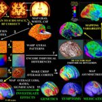 imaging_cervello