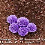 mrsa