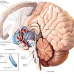parkinson