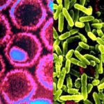 Pseudomonas_aeruginosa