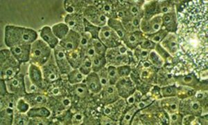 StemCellLive StemCellLive 300x181 Cancro al fegato: cellule staminali super potenti resistenti alla chemio