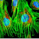 fibroblasti