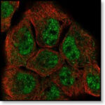 TSLP_protein