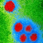 dengue