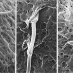 spermatozoi