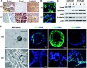 virus cancer 300x234 Virus geneticamente modificato per distruggere tumori