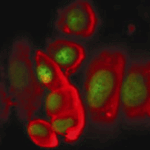fluorescenza_cellule_tumora