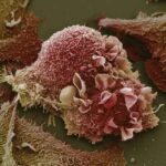 lung_cancer_cell
