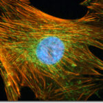 lung_cells