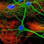 SERT_serotonina