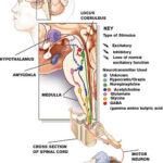 narcolepsy