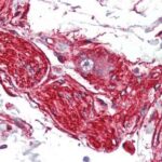 proteina_S100A10